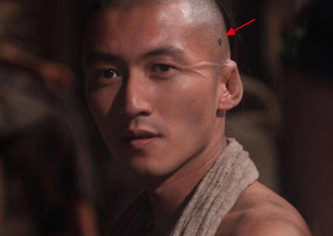 Tạ Đình Phong gây hoang mang khi lộ dấu hiệu của bệnh ung thư?-6