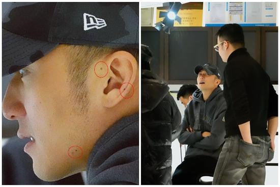 Tạ Đình Phong gây hoang mang khi lộ dấu hiệu của bệnh ung thư?