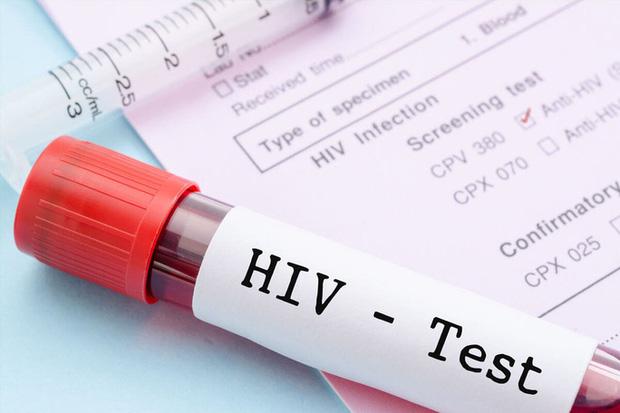 Vì sao độ tuổi được xét nghiệm HIV tự nguyện giảm xuống đủ 15 tuổi?-1
