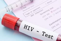 Vì sao độ tuổi được xét nghiệm HIV tự nguyện giảm xuống đủ 15 tuổi?