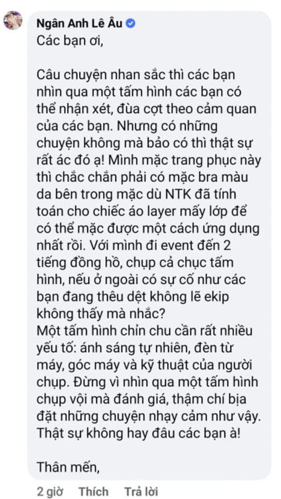 Lê Âu Ngân Anh bức xúc đáp trả khi bị nói phẫu thuật thẩm mỹ hỏng ngày càng nhận không ra-2