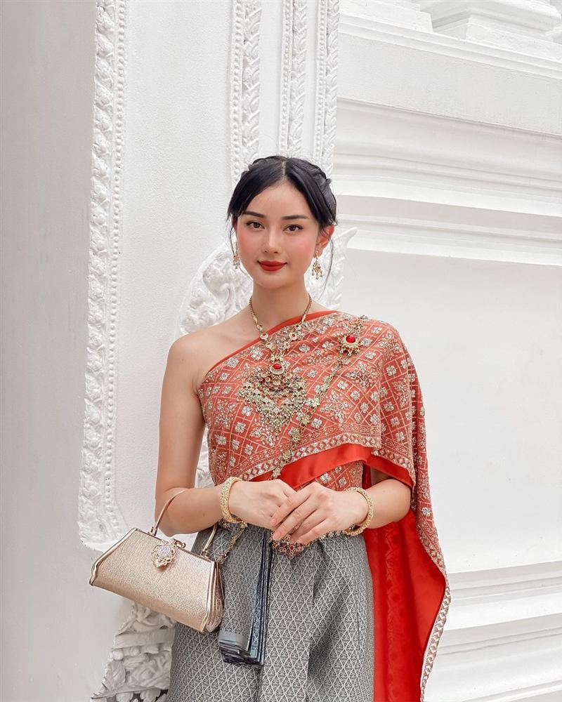 ‘Phạm Băng Băng phiên bản Việt’ chi cả trăm triệu đồng chữa hói-1