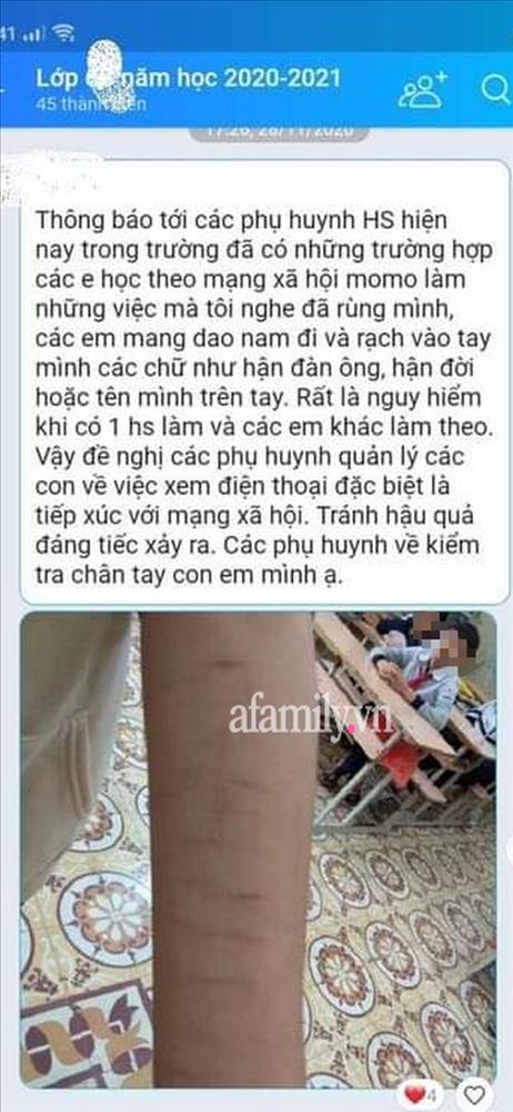 CẢNH BÁO: Nhiều học sinh dùng dao lam tự rạch cơ thể, coi đó là thú vui xả stress-2