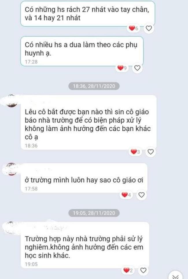 CẢNH BÁO: Nhiều học sinh dùng dao lam tự rạch cơ thể, coi đó là thú vui xả stress-3