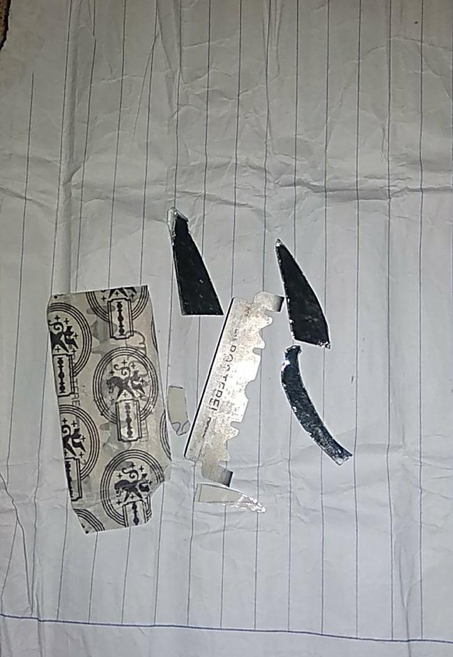 CẢNH BÁO: Nhiều học sinh dùng dao lam tự rạch cơ thể, coi đó là thú vui xả stress-5