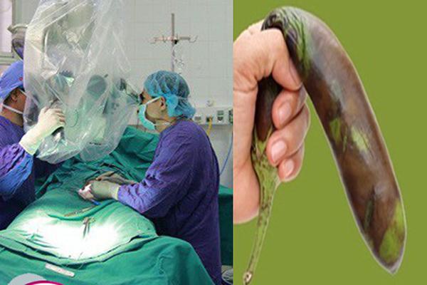 Khó chịu với cậu nhỏ, quý ông ở Hà Nội ra tay... bẻ gãy luôn-1