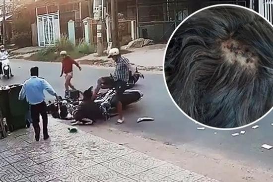 Vụ đánh nữ sinh sau tai nạn giao thông: Nạn nhân đau đầu, tinh thần hoảng loạn, phải nghỉ học