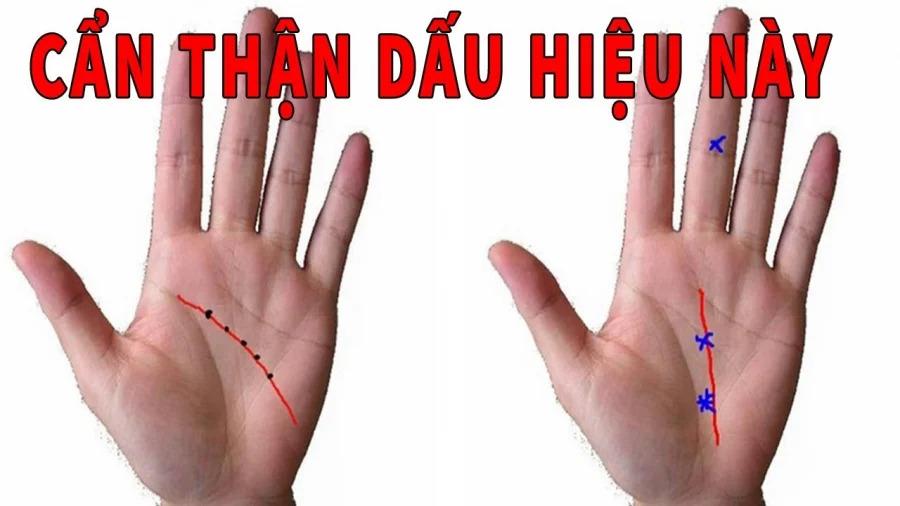 Người sở hữu tướng bàn tay tán lộc: Cả đời nghèo khổ, quần quật vẫn không thoát nghèo-1