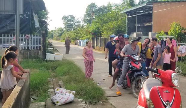 Mâu thuẫn trong lúc nhậu, 1 người bị chém nhập viện-1