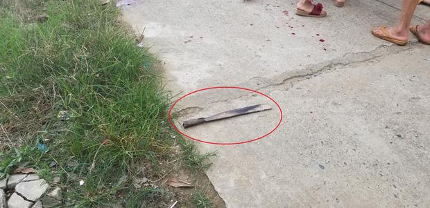 Mâu thuẫn trong lúc nhậu, 1 người bị chém nhập viện-2