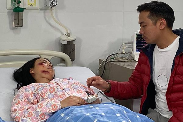 Linh Miu mặt mũi bầm tím sau phát ngôn chúc mừng nghệ sĩ Chí Tài qua đời-4