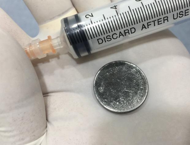 Bé gái 4 tuổi nuốt đồng xu vào bụng trong lúc chơi đùa-2