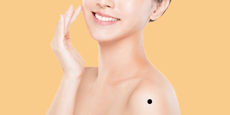 Sự thật về 5 nốt ruồi hao tài tốn của, ai sở hữu thì nên sớm xóa bỏ-2