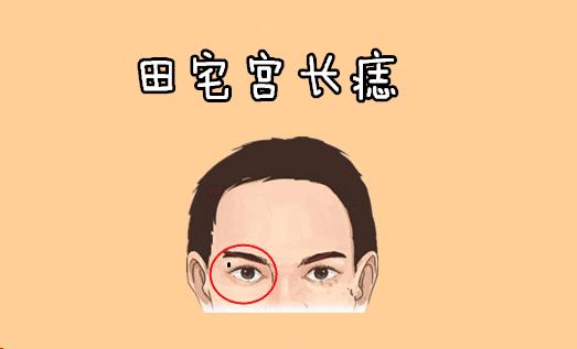 Sự thật về 5 nốt ruồi hao tài tốn của, ai sở hữu thì nên sớm xóa bỏ-3