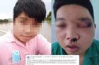 Lan truyền ảnh thanh niên Tây Ninh phát ngôn sốc về nghệ sĩ Chí Tài bị đánh sưng mặt mũi