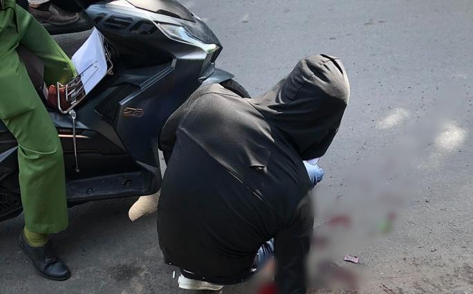 Bước ra từ quán cơm, thanh niên bị 2 người lạ chém gần đứt lìa cẳng tay-1