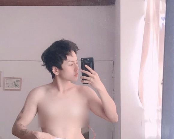 Bạn trai chuyển giới của Miko Lan Trinh khoe ngực sau 2 tháng cắt bỏ-3