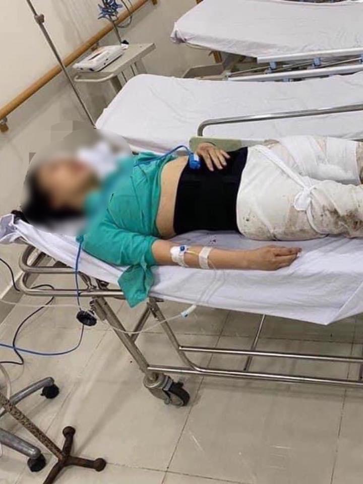 Nữ tiếp viên bị tài xế Mercedes đâm kể về nỗi đau 4 lần phẫu thuật sau tai nạn-1