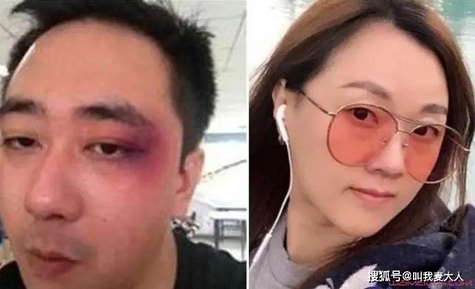 Nam diễn viên 30 chưa phải là hết bị vợ cũ tát hơn 500 cái, nhập viện 8 lần-2