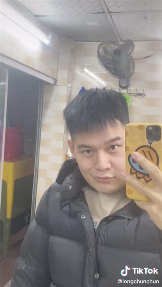 Xuất viện sau 1 tháng điều trị u men xương hàm, Long Chun mong khán giả không kỳ thị hình dáng-3