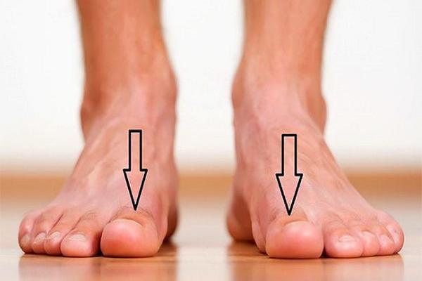 Đây là tướng bàn chân phú quý, phụ nữ nào sở hữu thì xác định đời này giàu sang-4