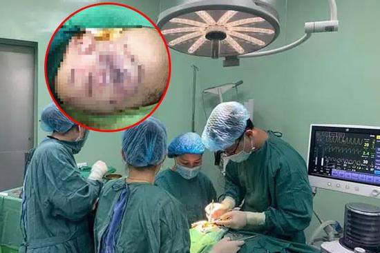 Bé trai 2 tuổi ở Nghệ An bị chó nhà nuôi cắn nát mặt, tổn thương nặng