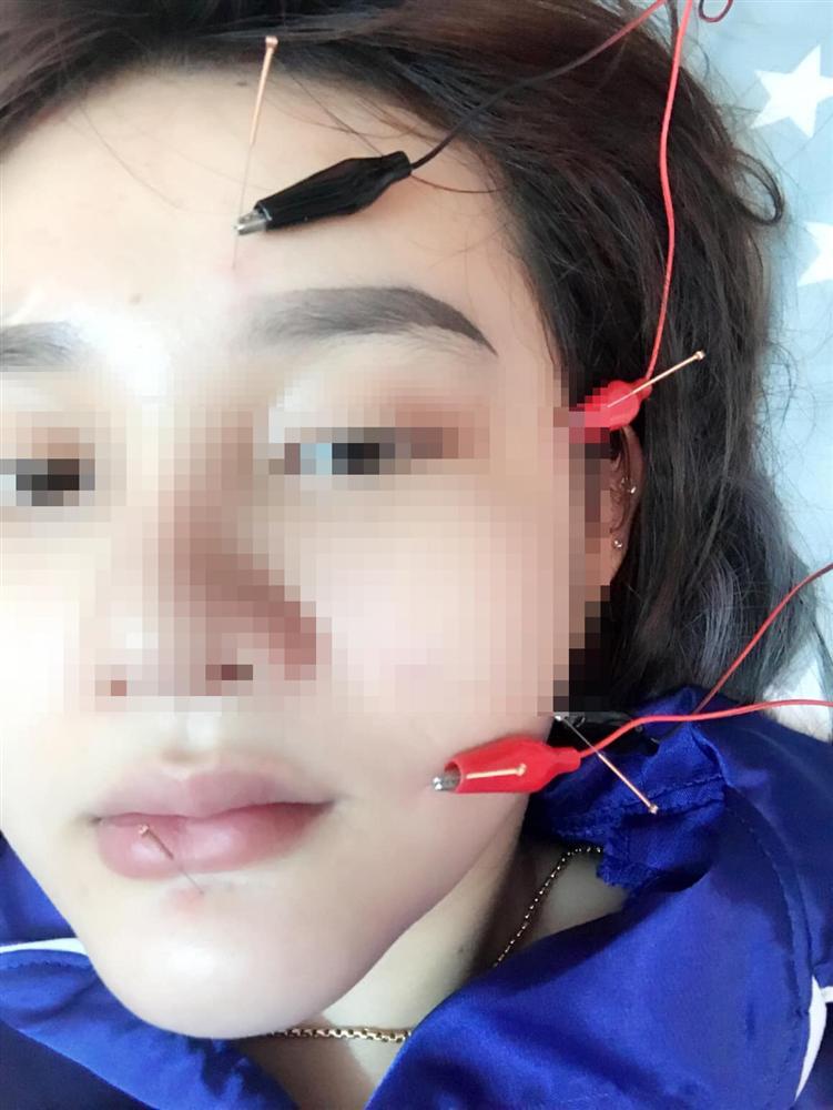 Cố tình tắm đêm, cô gái hoảng sợ khi thấy máu mũi liên tục chảy-3