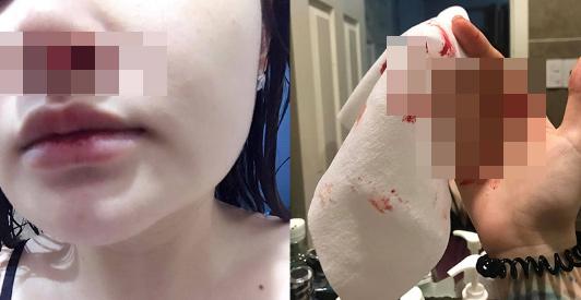 Cố tình tắm đêm, cô gái hoảng sợ khi thấy máu mũi liên tục chảy-2