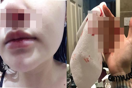 Cố tình tắm đêm, cô gái hoảng sợ khi thấy máu mũi liên tục chảy