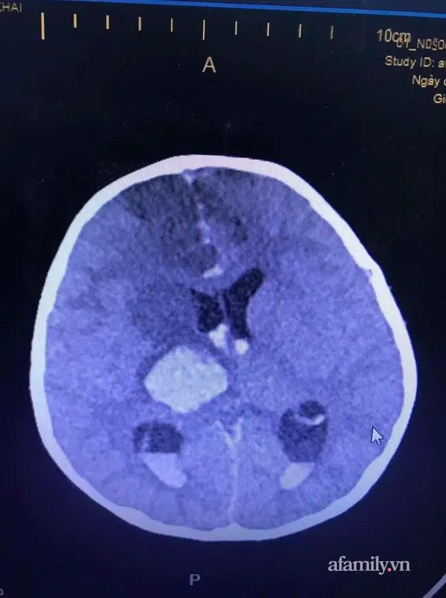 Đau xót gia cảnh bé trai 4 tuổi bị dượng đâm xuyên mắt: Cha vừa bị bác họ sát hại 4 tháng trước-9