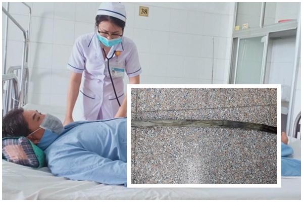 Đang cưa gỗ, người đàn ông bị thanh gỗ nửa mét đâm xuyên cổ-2