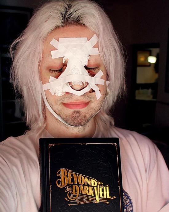 Chi 100.000 USD phẫu thuật thành yêu tinh-2