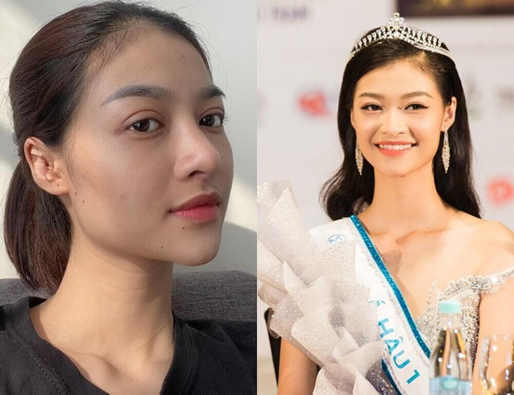 Không hẹn mà gặp, 3 Á hậu 1 đều dính nghi án dao kéo: Riêng Kiều Loan ẵm trọn combo-12