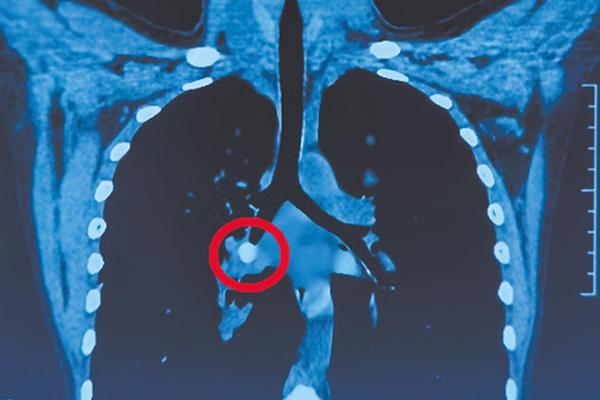 Chàng trai 36 tuổi mẹ vẫn đút cơm, nghiện nặng game online-5