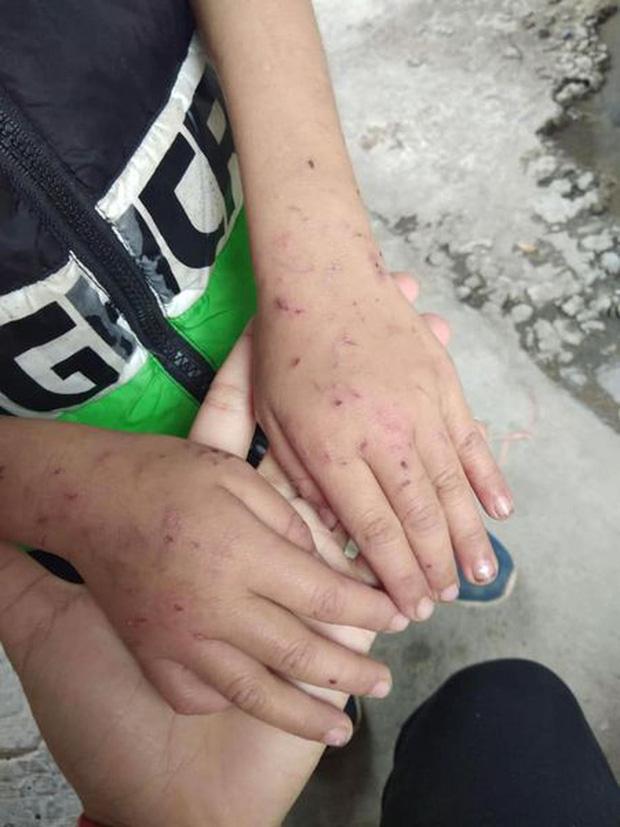 Thái Bình: Bé trai bị bà ngoại ngược đãi, bắt cởi truồng dưới cái lạnh buốt giá-3