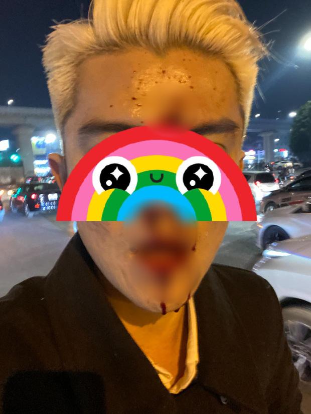 Xôn xao nam thanh niên bị đánh chảy máu mũi vì nhắc nhở tài xế dừng xe quá lâu gây tắc đường-1