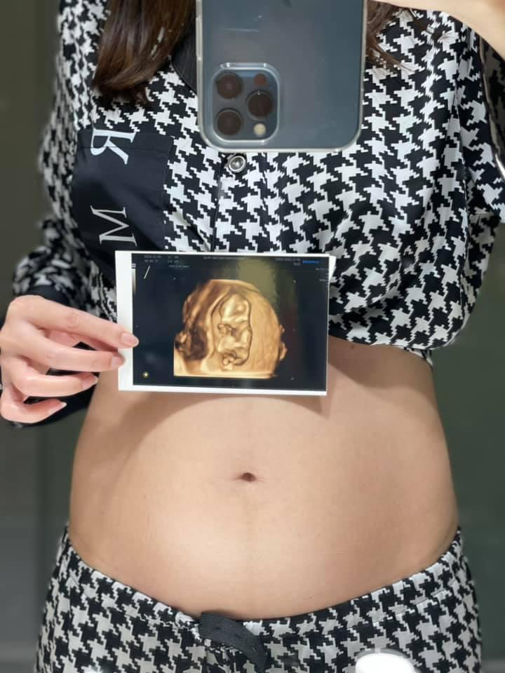 Quế Vân lần đầu khoe bụng bầu sau khi công khai tác giả thai nhi-1