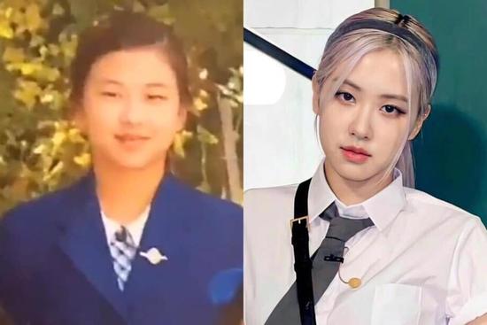 BLACKPINK Rosé lộ quá khứ khác lạ, nghi phẫu thuật thẩm mỹ