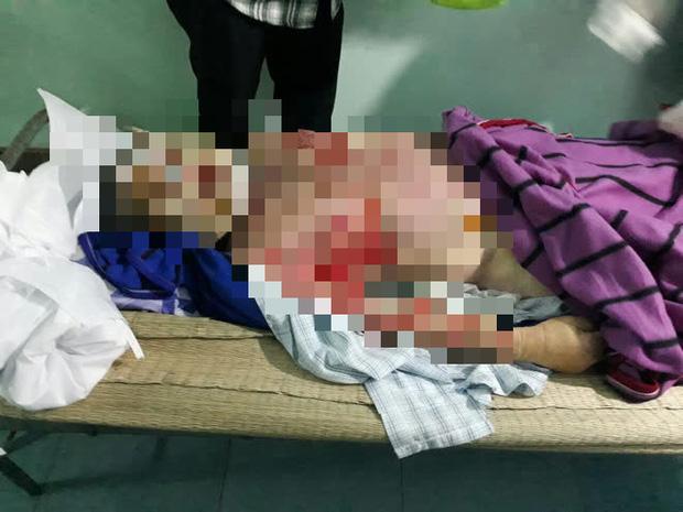 Người đàn ông bị lột da toàn thân, tử vong bất thường sau khi đi xông hơi-2