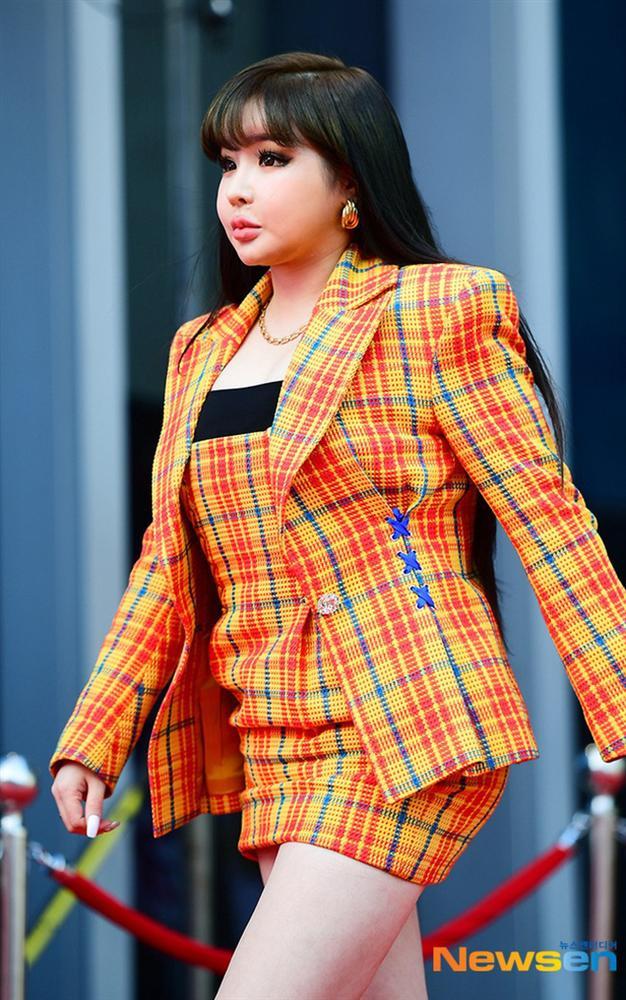 Park Bom lột xác đỉnh của chóp sau khi giảm 11kg khiến dân tình choáng váng-2