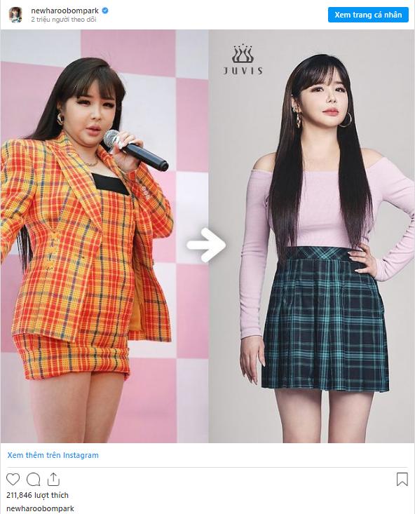 Park Bom lột xác đỉnh của chóp sau khi giảm 11kg khiến dân tình choáng váng-3