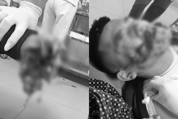 Nghệ An: 1 học sinh tử vong, 4 người trọng thương nghi do tự chế pháo nổ-2