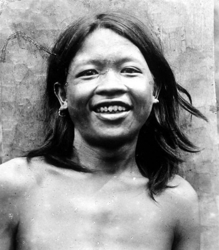 7 xu hướng làm đẹp kinh hoàng từng là chuẩn mực trong quá khứ-5