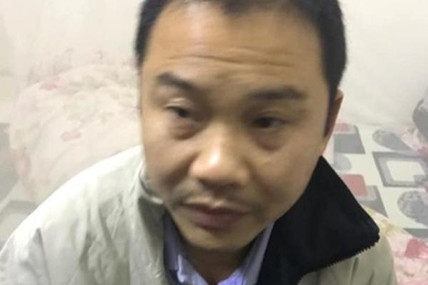 Nhờ cha dượng bôi thuốc, cô gái tự đẩy mình vào bi kịch ám ảnh 20 năm-2