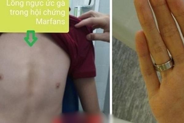 Người phụ nữ ở TP.HCM mắc bệnh hiếm khiến tóc rụng nửa đầu-2