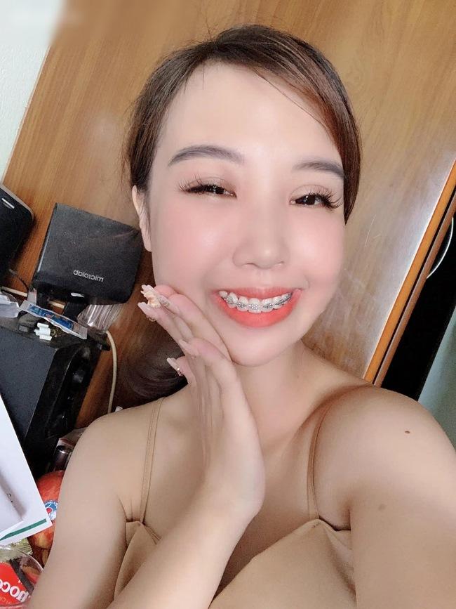 9X bị hội chứng kém phát triển một bên mặt lột xác như hot girl sau thẩm mỹ-4