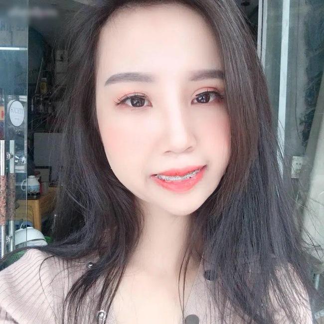 9X bị hội chứng kém phát triển một bên mặt lột xác như hot girl sau thẩm mỹ-7