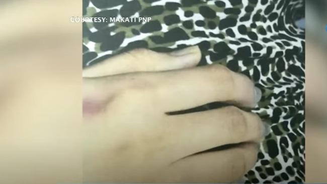 Nghi phạm giải thích những vết bầm trên cơ thể Á hậu Philippines-2