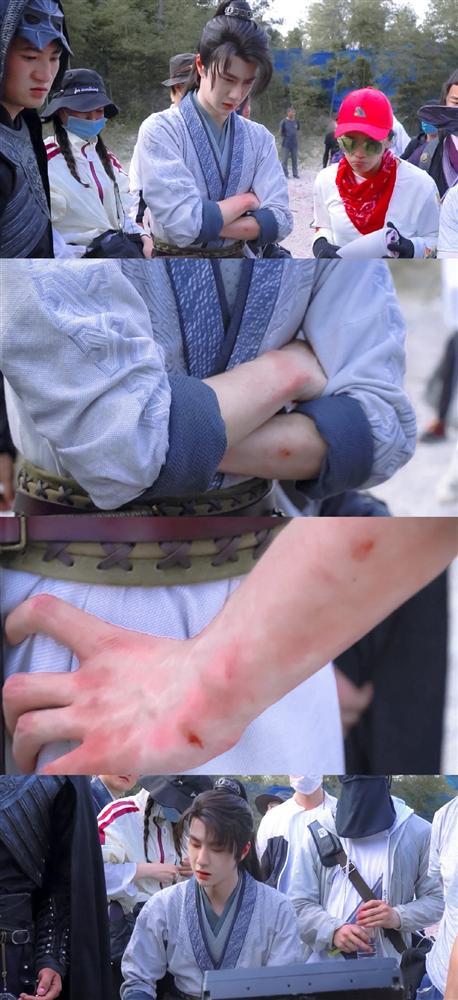 Vương Nhất Bác bị thương vì tự thực hiện cảnh hành động-3