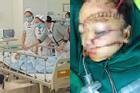 Bé trai 5 tuổi bị bố chém khâu hơn 300 mũi, bệnh viện cấp cứu mức 'báo động đỏ'